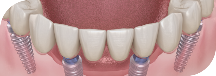 | premier center for oral dental implant facial surgery